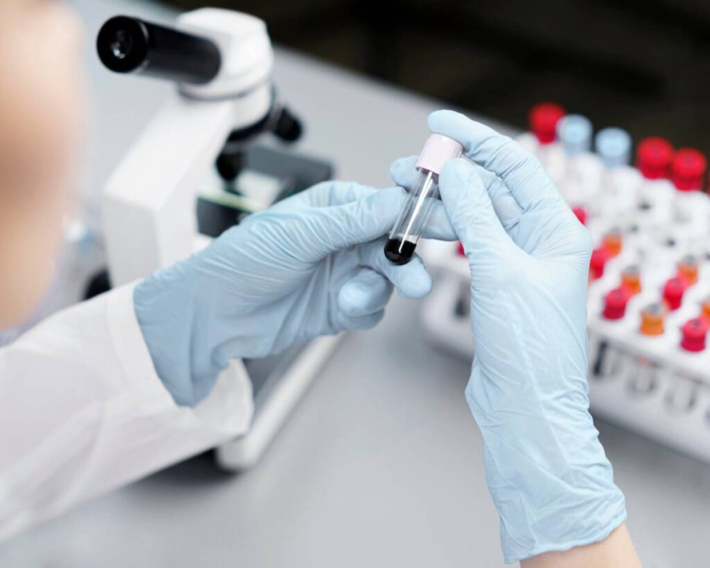 Lab technician wearing gloves inspecting a blood sample in a vial with a microscope in the background.