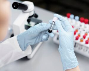 Lab technician wearing gloves inspecting a blood sample in a vial with a microscope in the background.